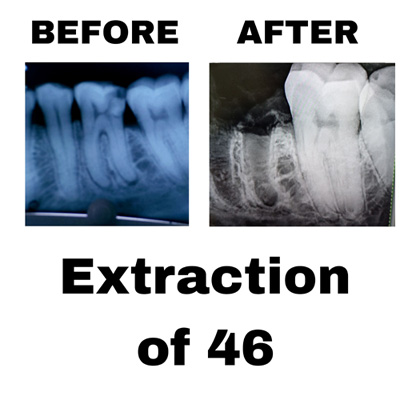 6aa
